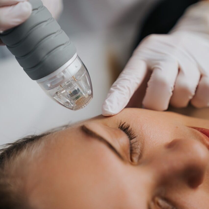 Microneedle RF lifting in a beauty salon. Big plan. High quality photo