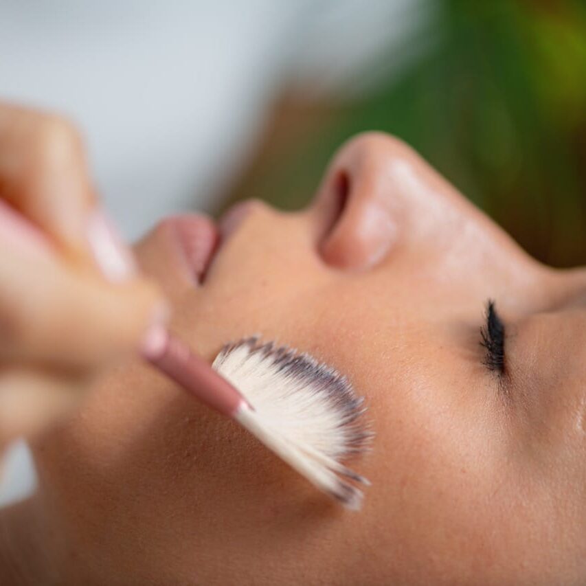 Skin rejuvenation with TCA chemical peel treatment, known for its exfoliating and anti-aging benefits